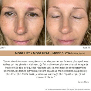 Elyo Skin Pro - Appareil anti - âge LED & EMS - Elyora Paris