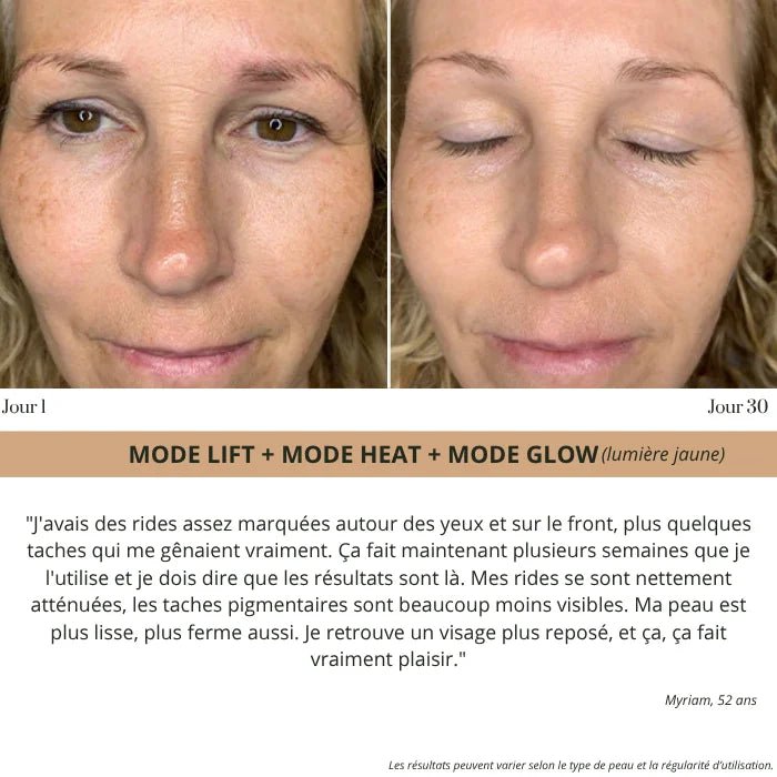 Elyo Skin Pro - Appareil anti - âge LED & EMS - Elyora Paris