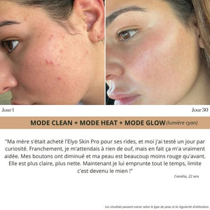 Elyo Skin Pro - Appareil anti - âge LED & EMS - Elyora Paris