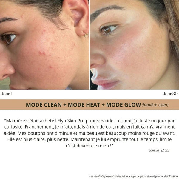 Elyo Skin Pro - Appareil anti - âge LED & EMS - Elyora Paris