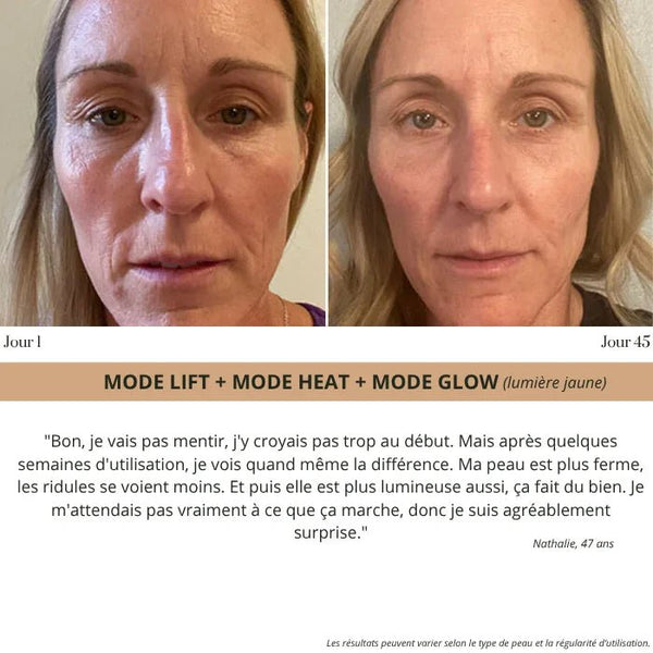 Elyo Skin Pro - Appareil anti - âge LED & EMS - Elyora Paris