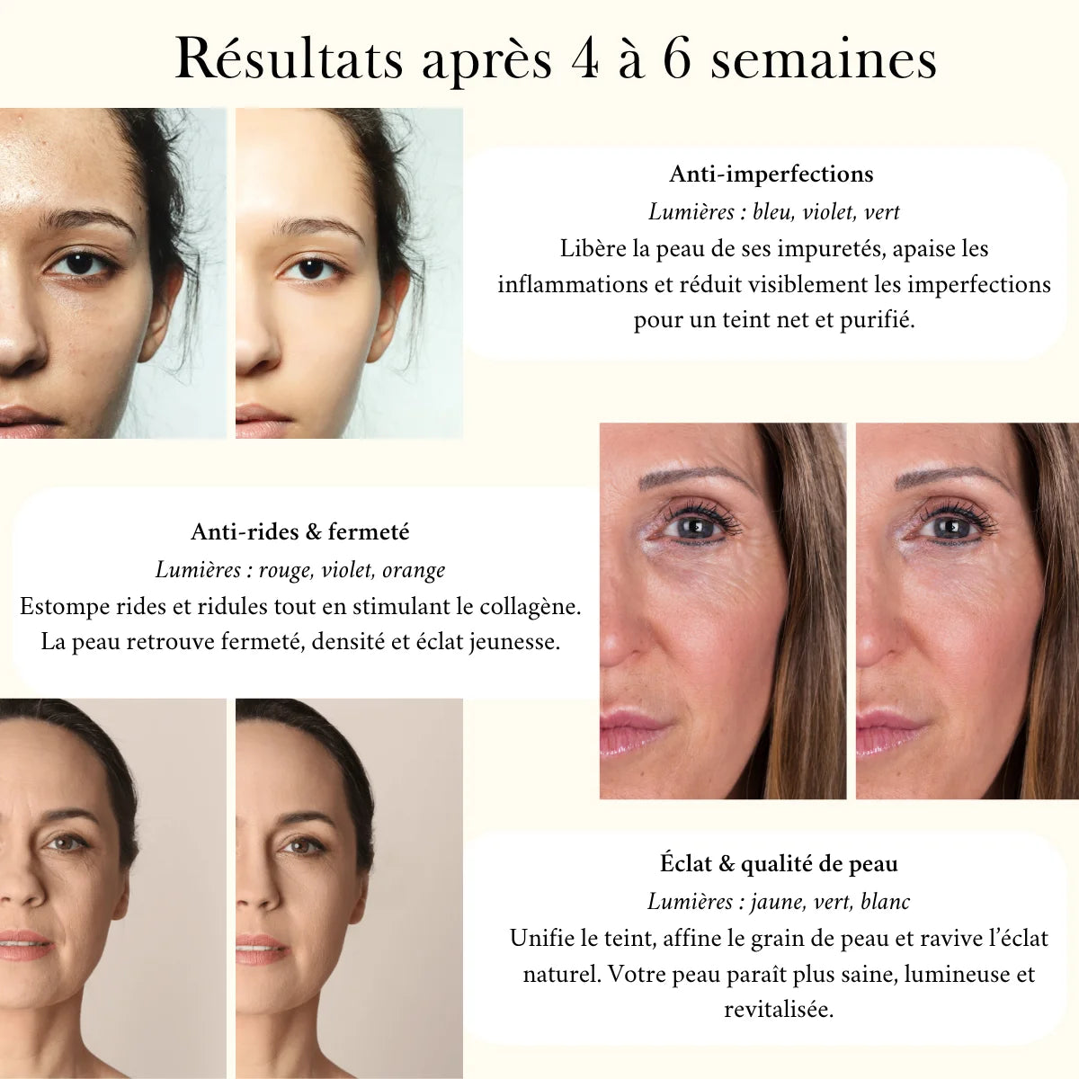Elyo Derm 7 - Appareil de luminothérapie Multi-âge