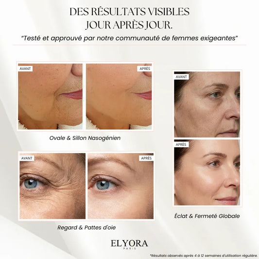 Appareil Anti-Âge LED et EMS - Elyo Skin Pro