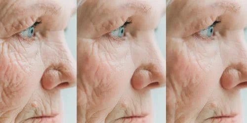 Comment Réactiver la Production de Collagène (Même Après 50 Ans) : Guide 3 Étapes - Elyora Paris