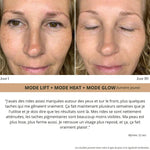 Elyo Skin Pro - Appareil anti - âge LED & EMS - Elyora Paris