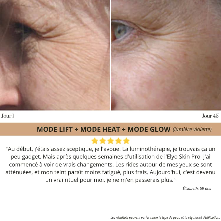 Elyo Skin Pro - Appareil anti - âge LED & EMS - Elyora Paris
