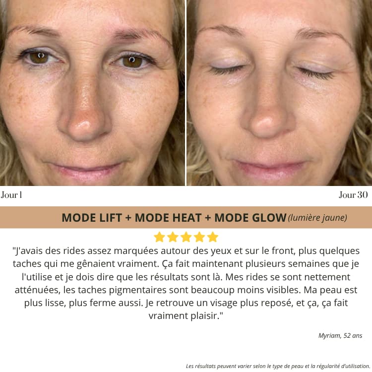 Elyo Skin Pro - Appareil anti - âge LED & EMS - Elyora Paris