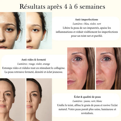 Elyo Derm  7 - Appareil de luminothérapie Multi-âge