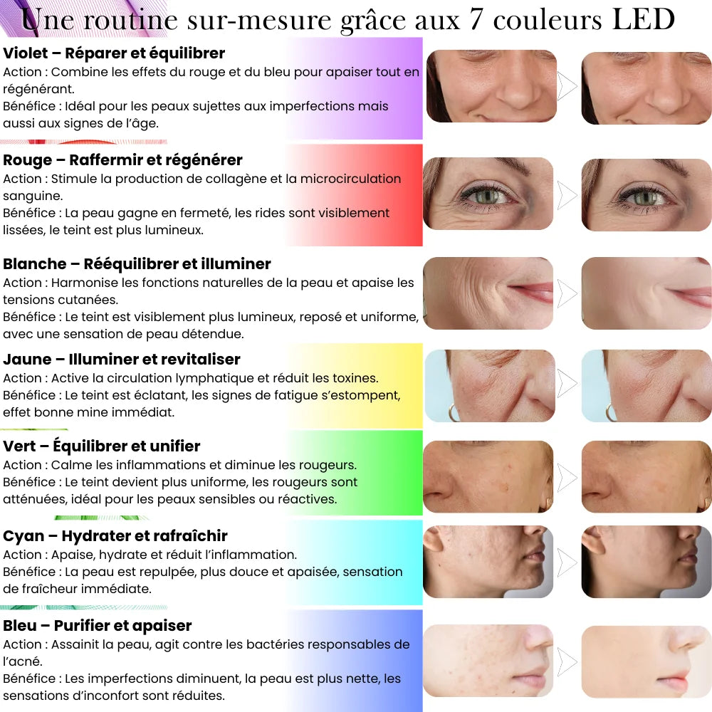 Elyo Derm  7 - Appareil de luminothérapie Multi-âge