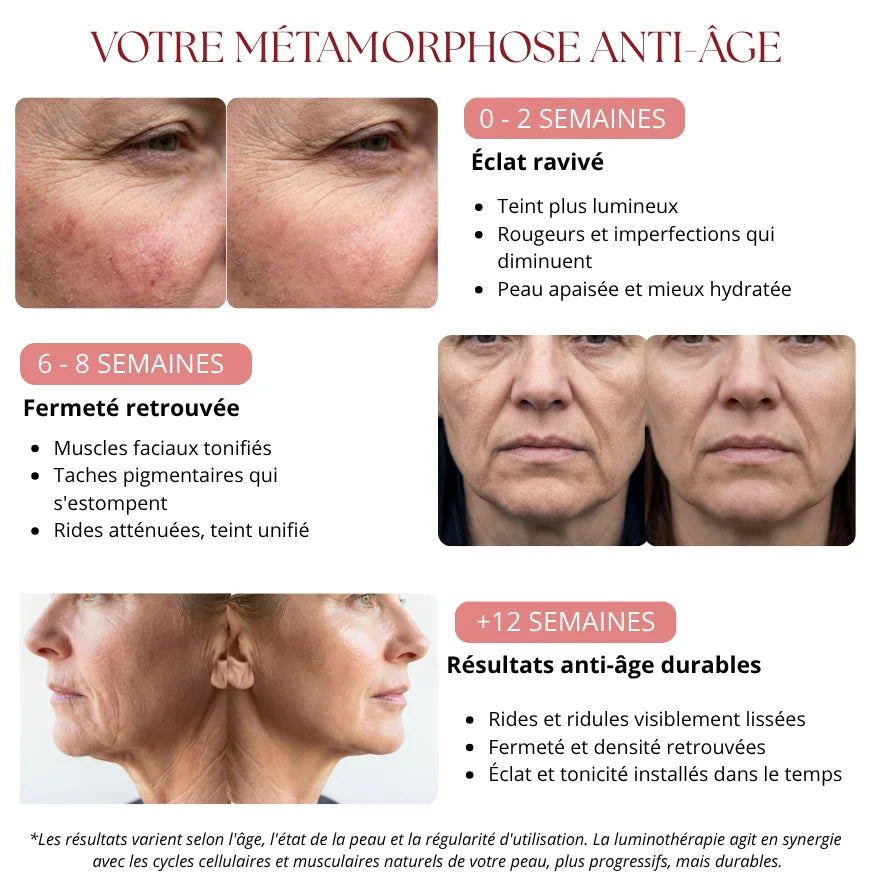 Méthode Elyora Paris | Rituel Anti-Âge LED & EMS